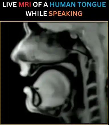 Live MRI of Human Tongue
